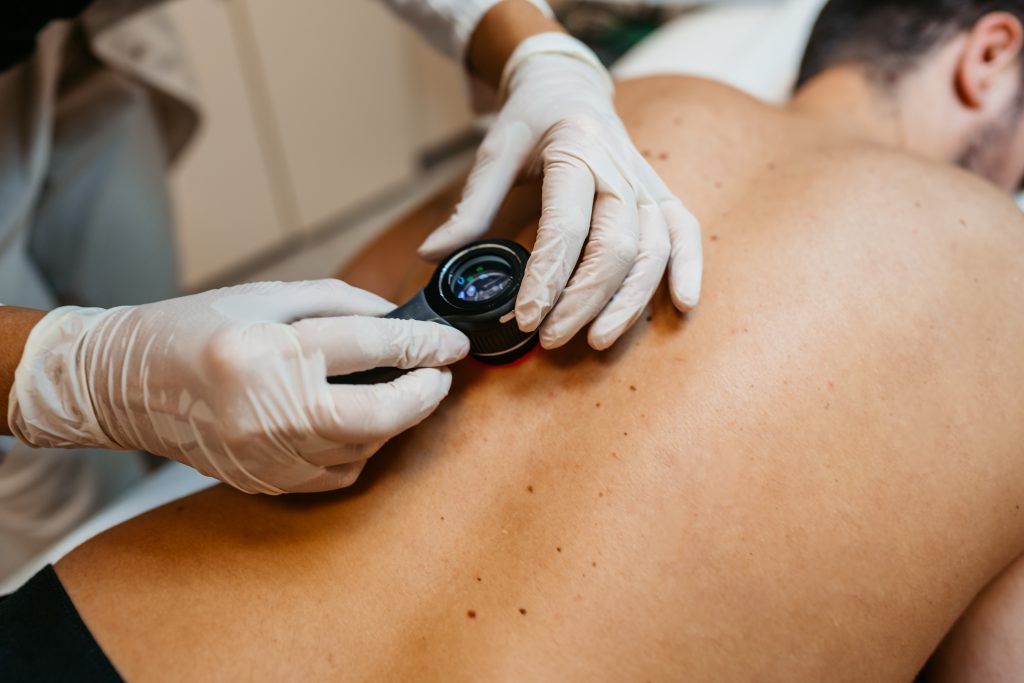 Ärztin untersucht Muttermale von Patienten